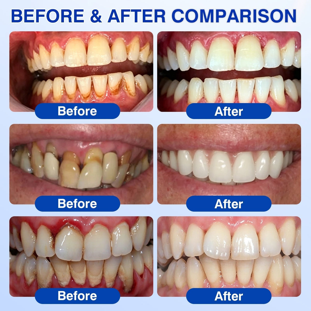 𝐇𝐈𝐒𝐊𝐈𝐍®👩‍⚕️🇬🇧🏅🦷🛡️ HISKIN® GumRevive Periodontal Repair Gel