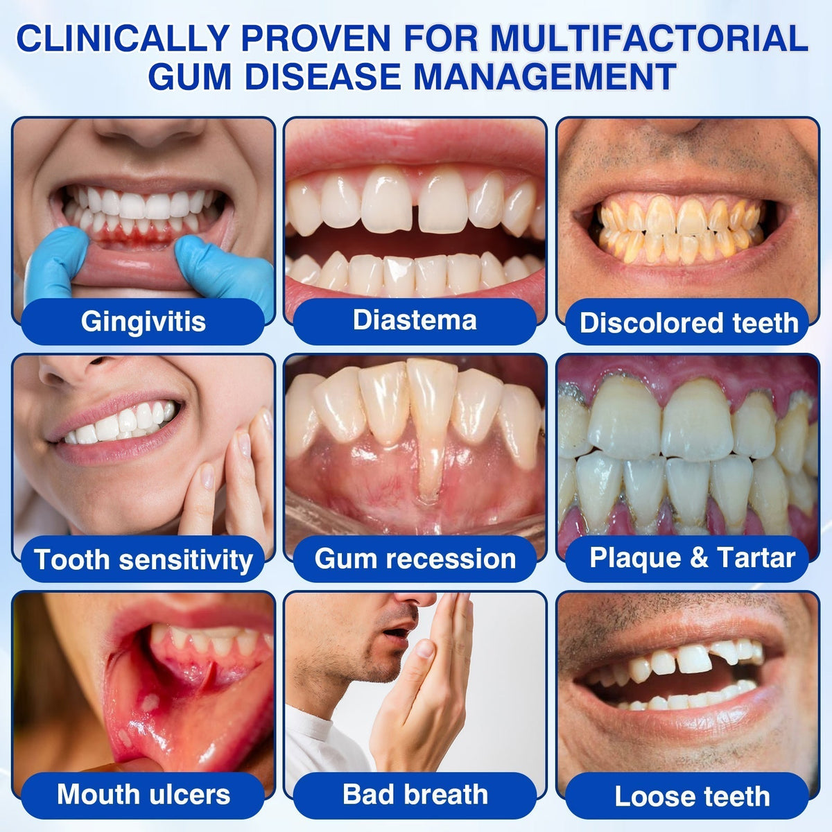 𝐇𝐈𝐒𝐊𝐈𝐍®👩‍⚕️🇬🇧🏅🦷🛡️ HISKIN® GumRevive Periodontal Repair Gel