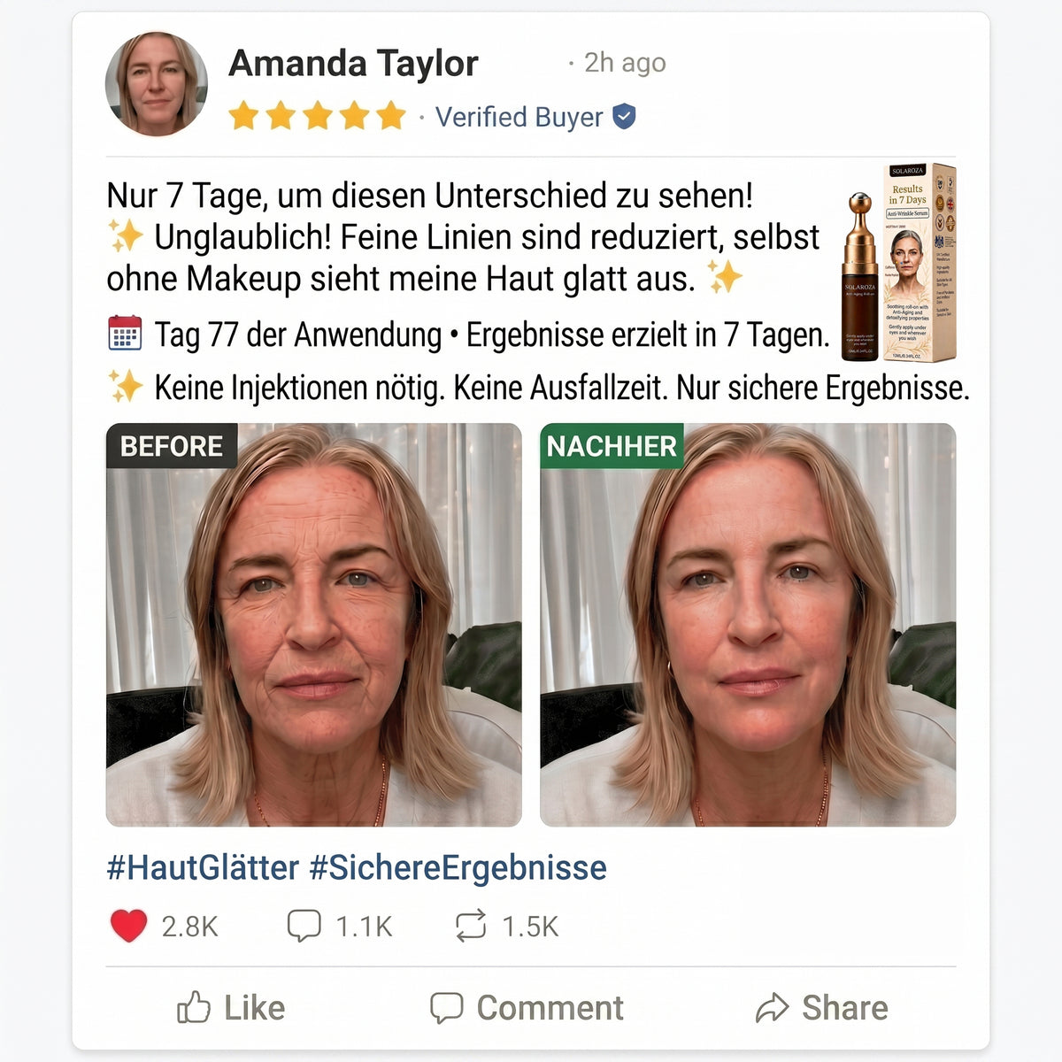 🔥New & Upgraded: Solaroza® 360° Ice-Cool Roller — Visibly reduces dark circles, puffiness, and fine lines in 7 days. Powered by Matrixyl 3000, Neuro-peptides, and Caffeine.