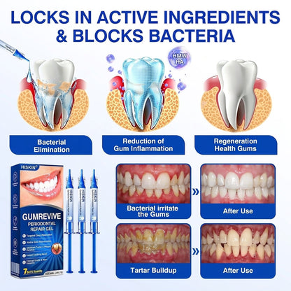 𝐇𝐈𝐒𝐊𝐈𝐍®👩‍⚕️🇬🇧🏅🦷🛡️ HISKIN® GumRevive Periodontal Repair Gel